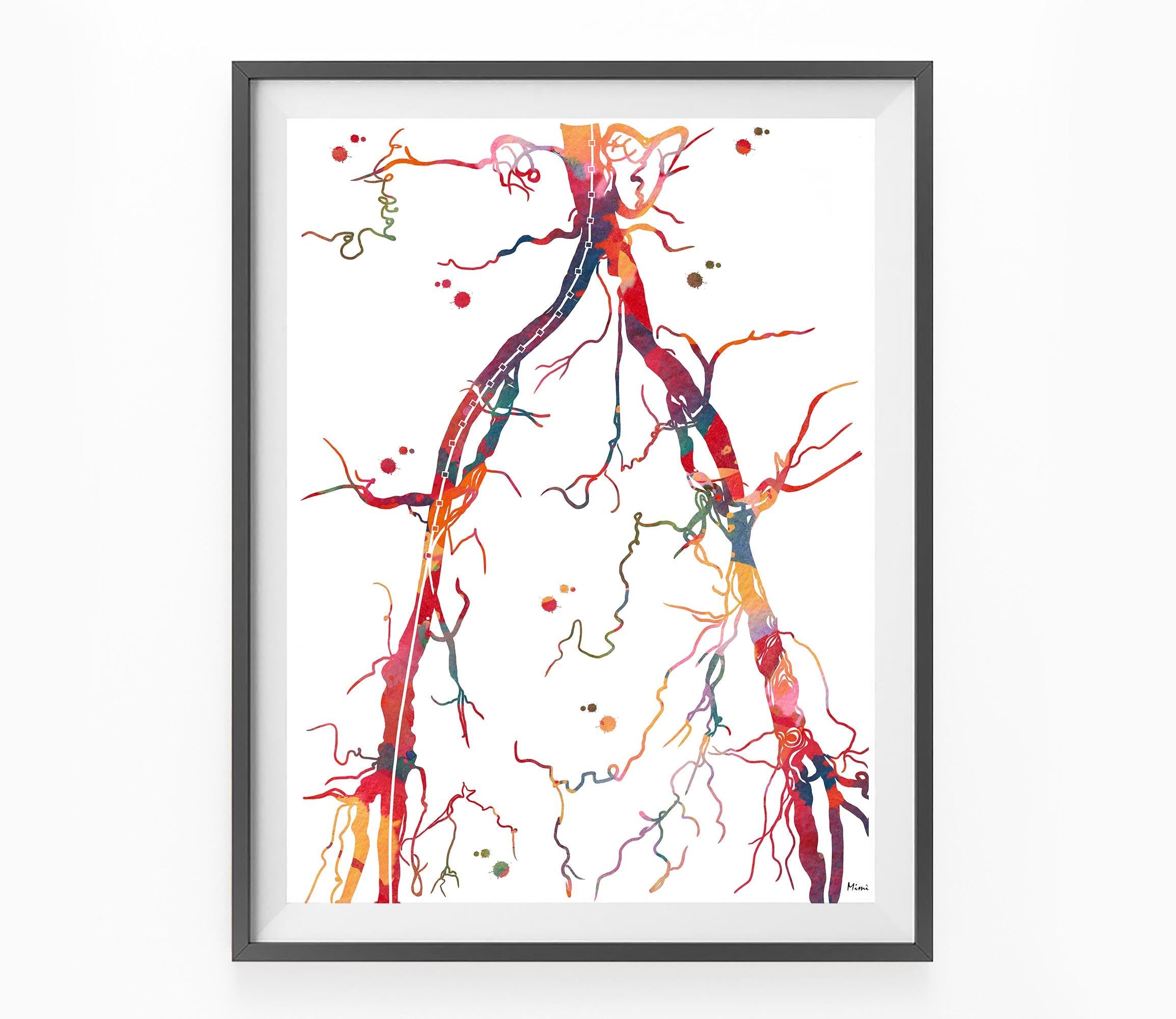 Framed artwork of colorful abdominal aortic angiogram watercolor art print by mimiprints on a white background