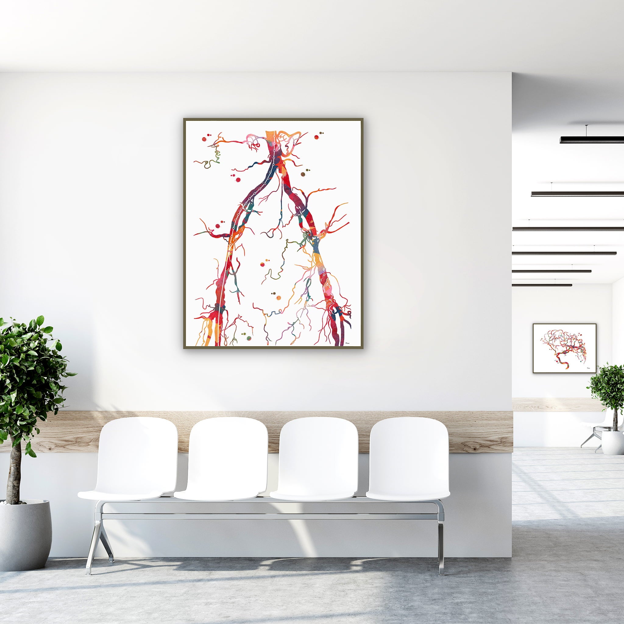 Framed abdominal aorta and pelvic arteries angiogram watercolor print in a clinic waiting room