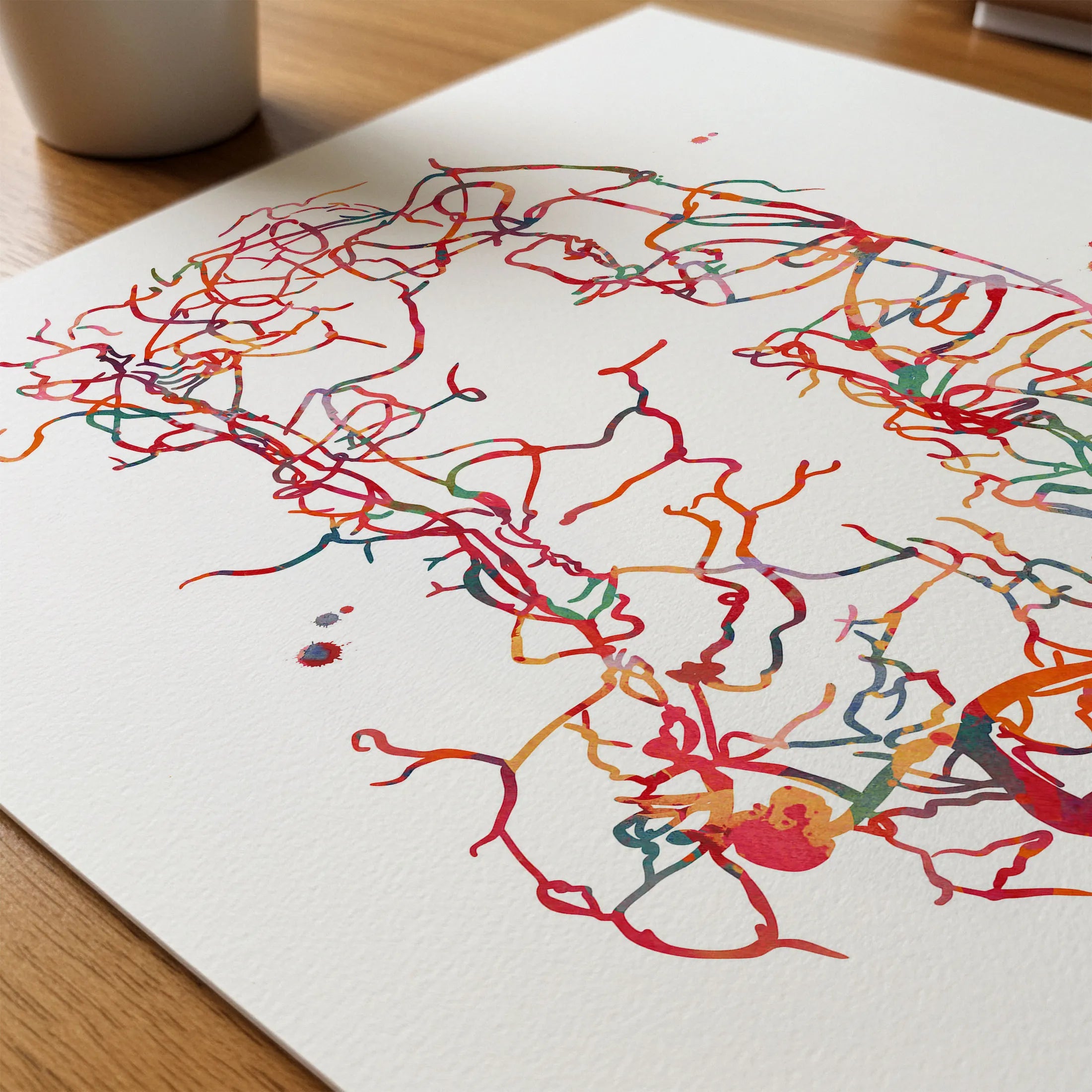 Close-up of cerebral aneurysm brain angiogram watercolor print showing paper texture and grain