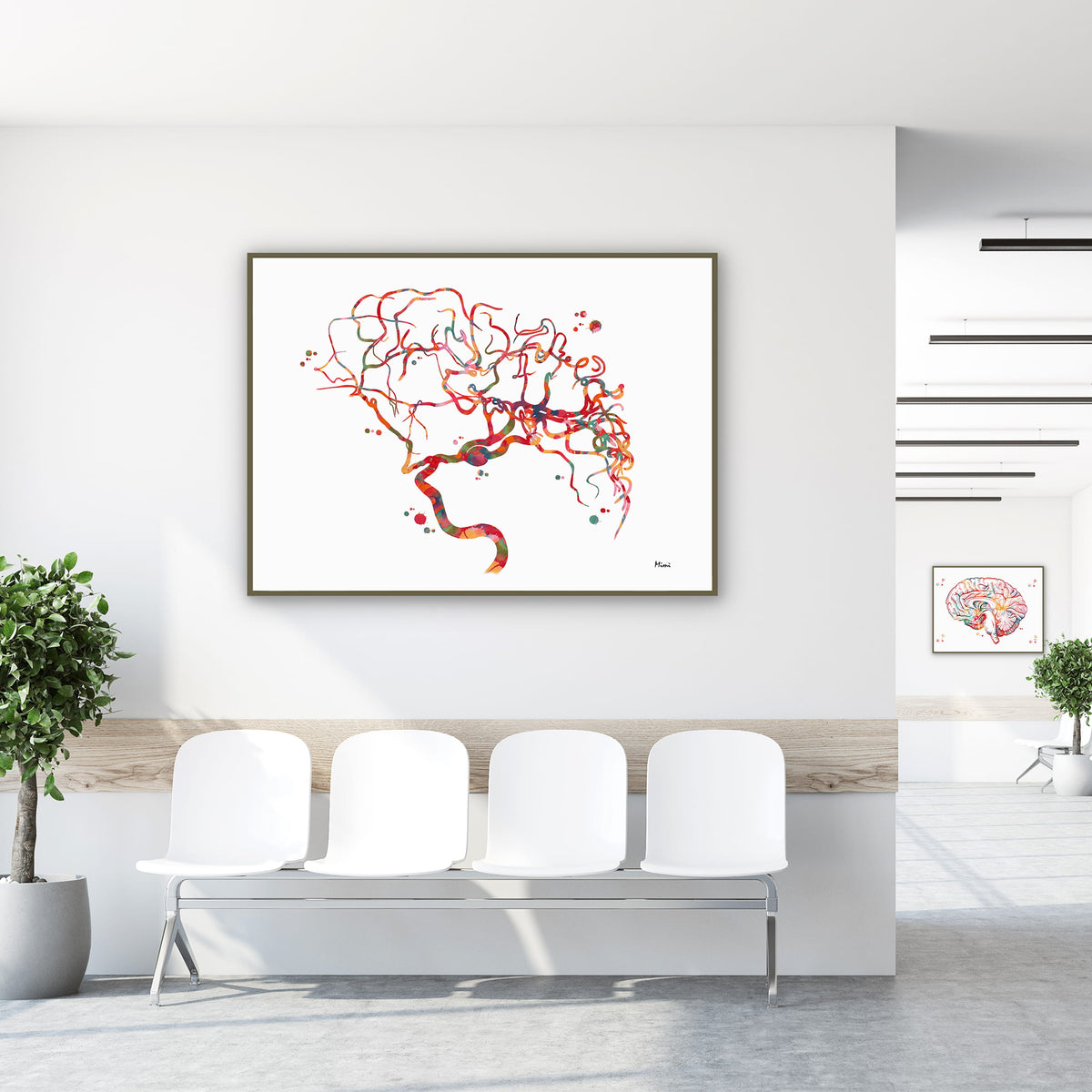 cerebral aneurysm watercolor print hanging in a clinic waiting room