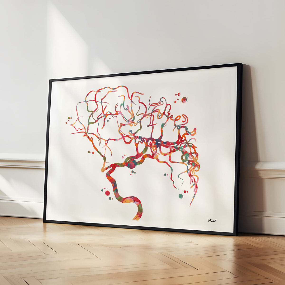 Framed Cerebral Aneurysm watercolor art print for Neurovascular Clinic wall decor