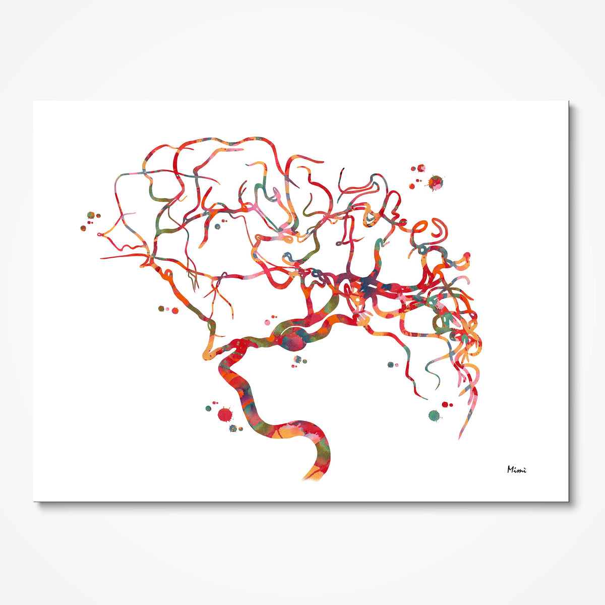Cerebral Aneurysm watercolor art print for Neurovascular Clinic wall decor