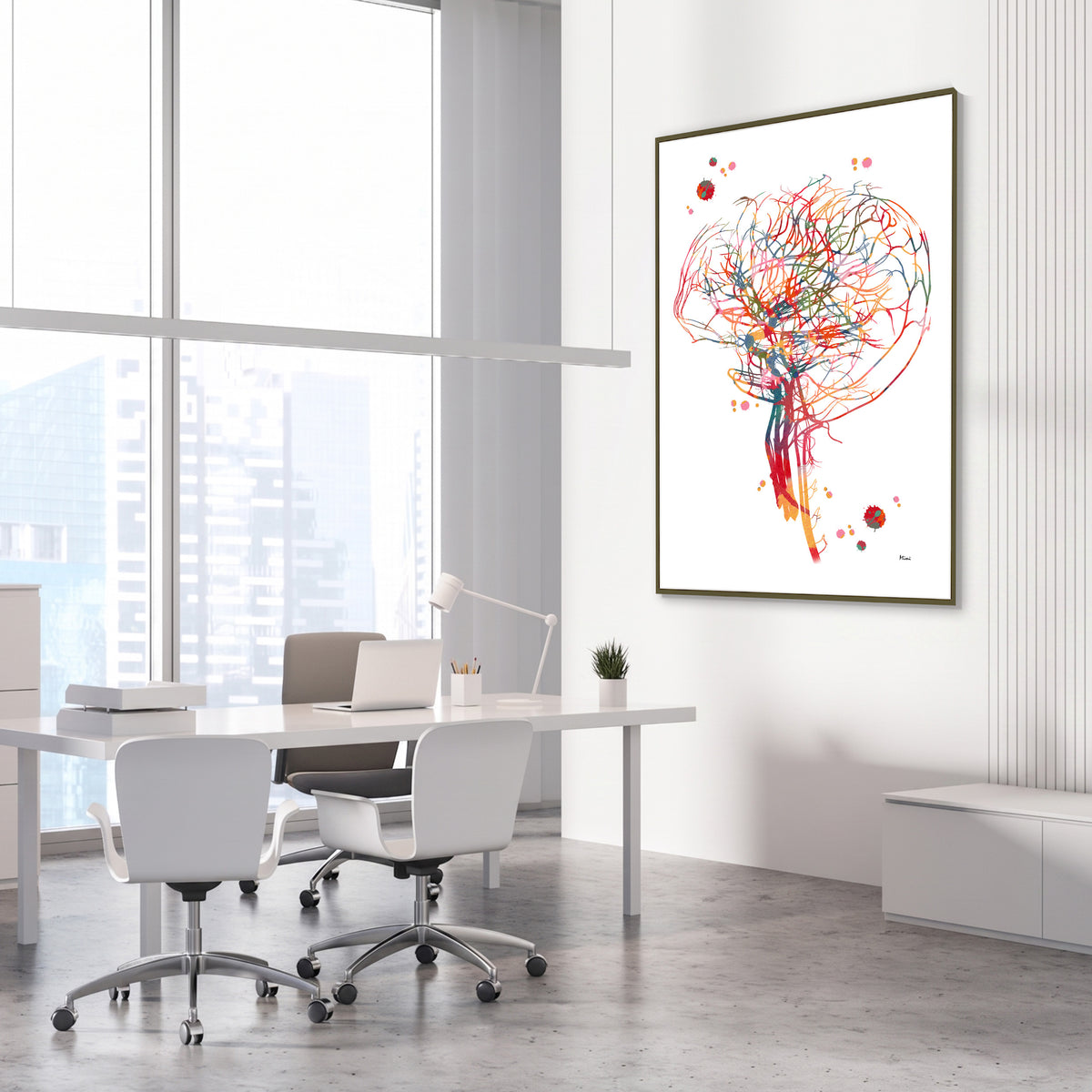 Framed cerebral angiography brain vascularization watercolor print in a vascular clinic