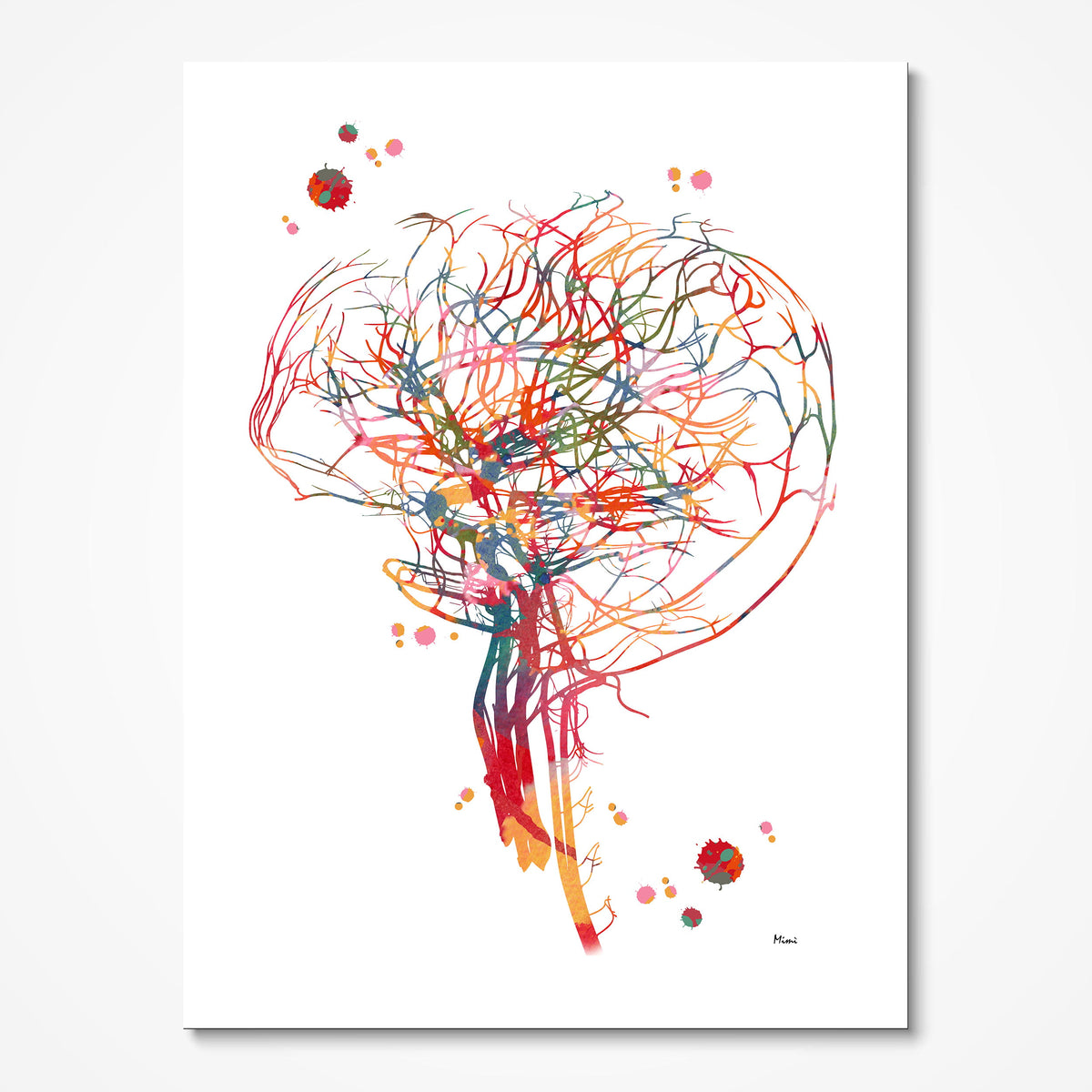 Cerebral angiography brain vascularization watercolor art print for vascular clinic wall decor