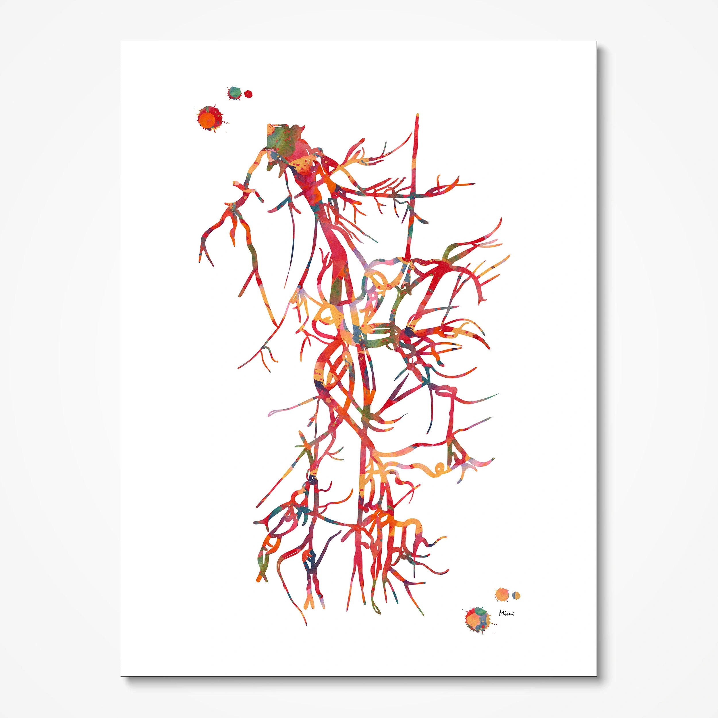 Iliac and femoral artery angiogram watercolor art print for vascular clinic wall decor