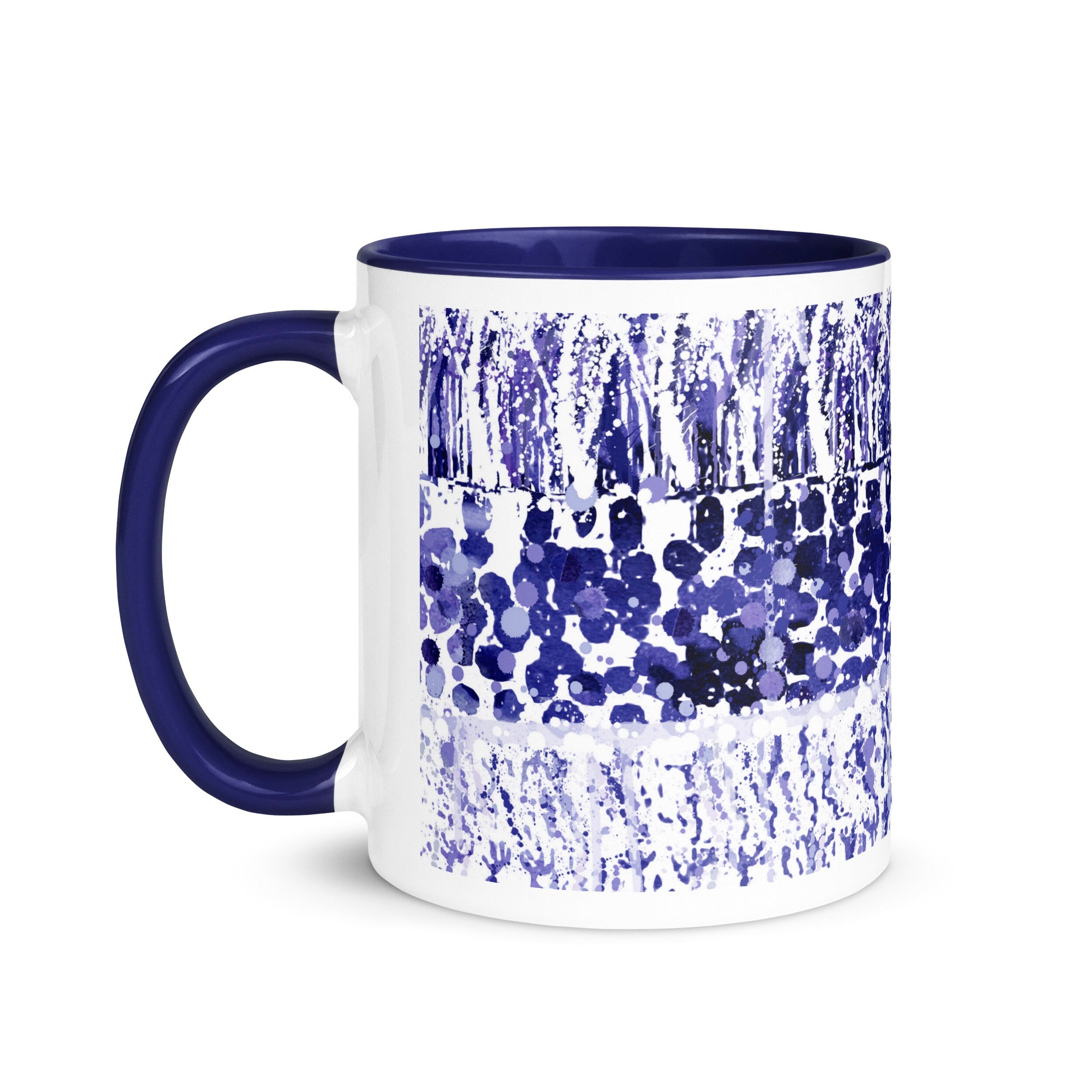 Retina Layers Anatomy Mug 11 OZ Image 1
