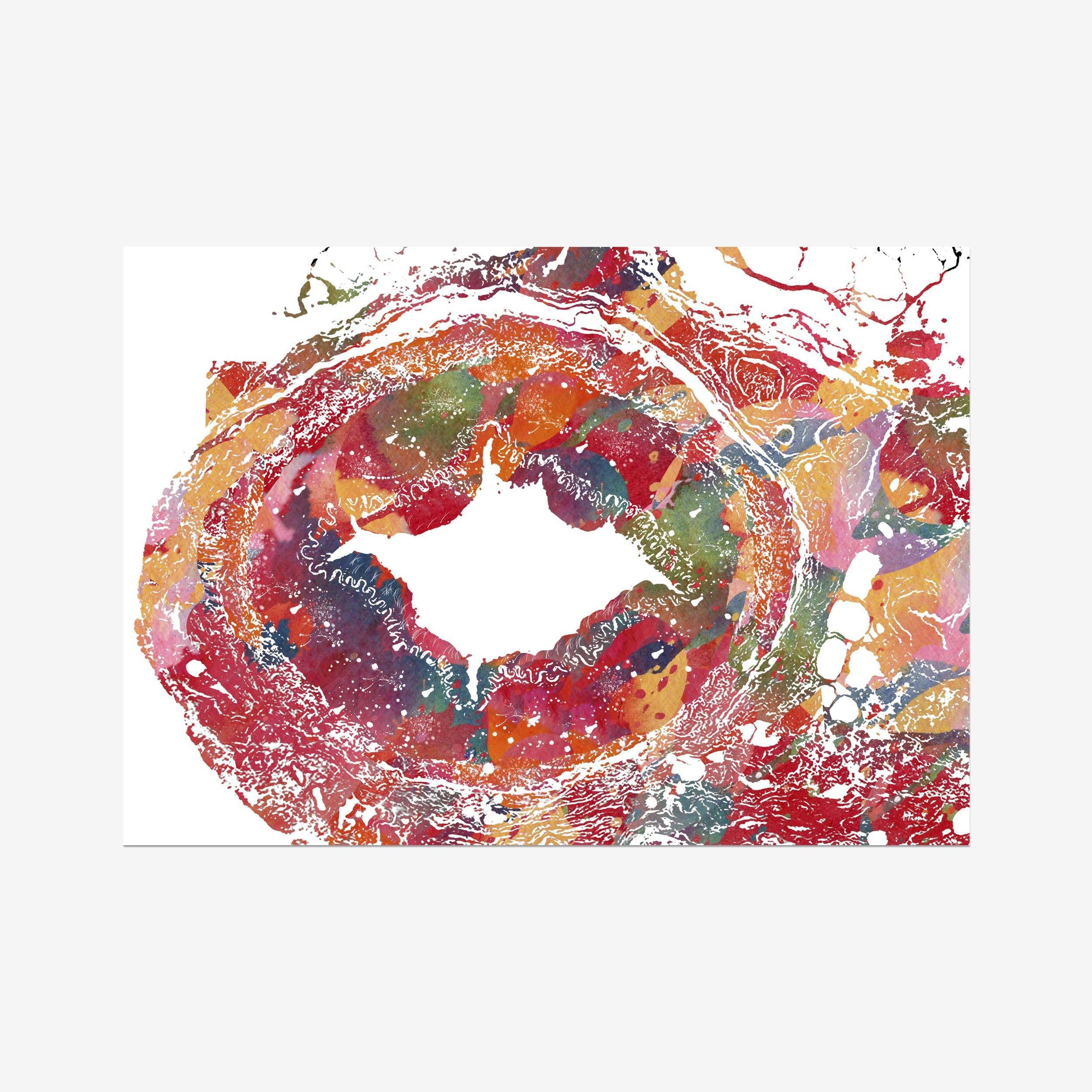 Temporal Artery Histology Watercolor Print