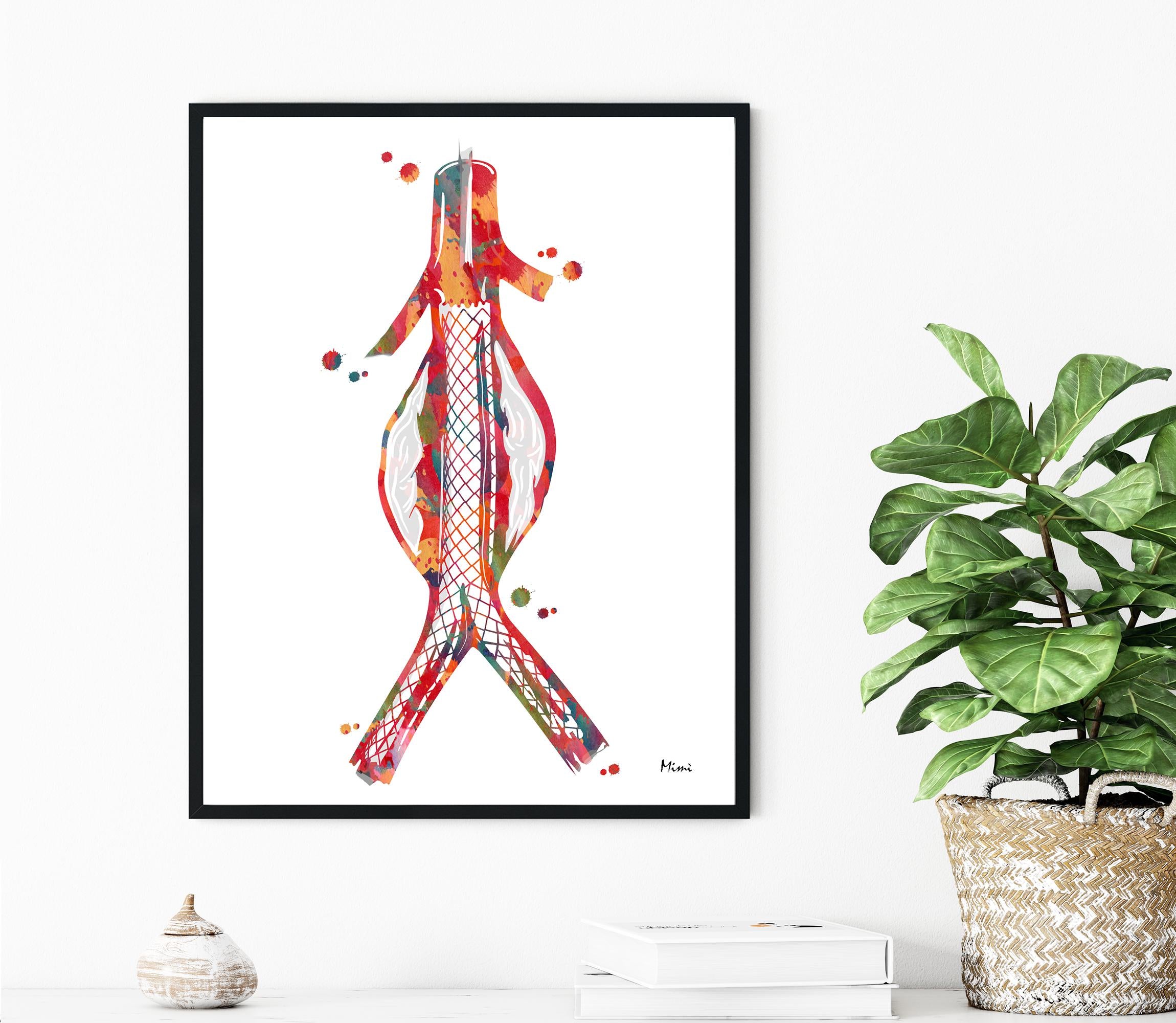 Colorful abstract art print of  the Abdominal Aortic Stent in a black frame on a white wall with a plant and decor items below.