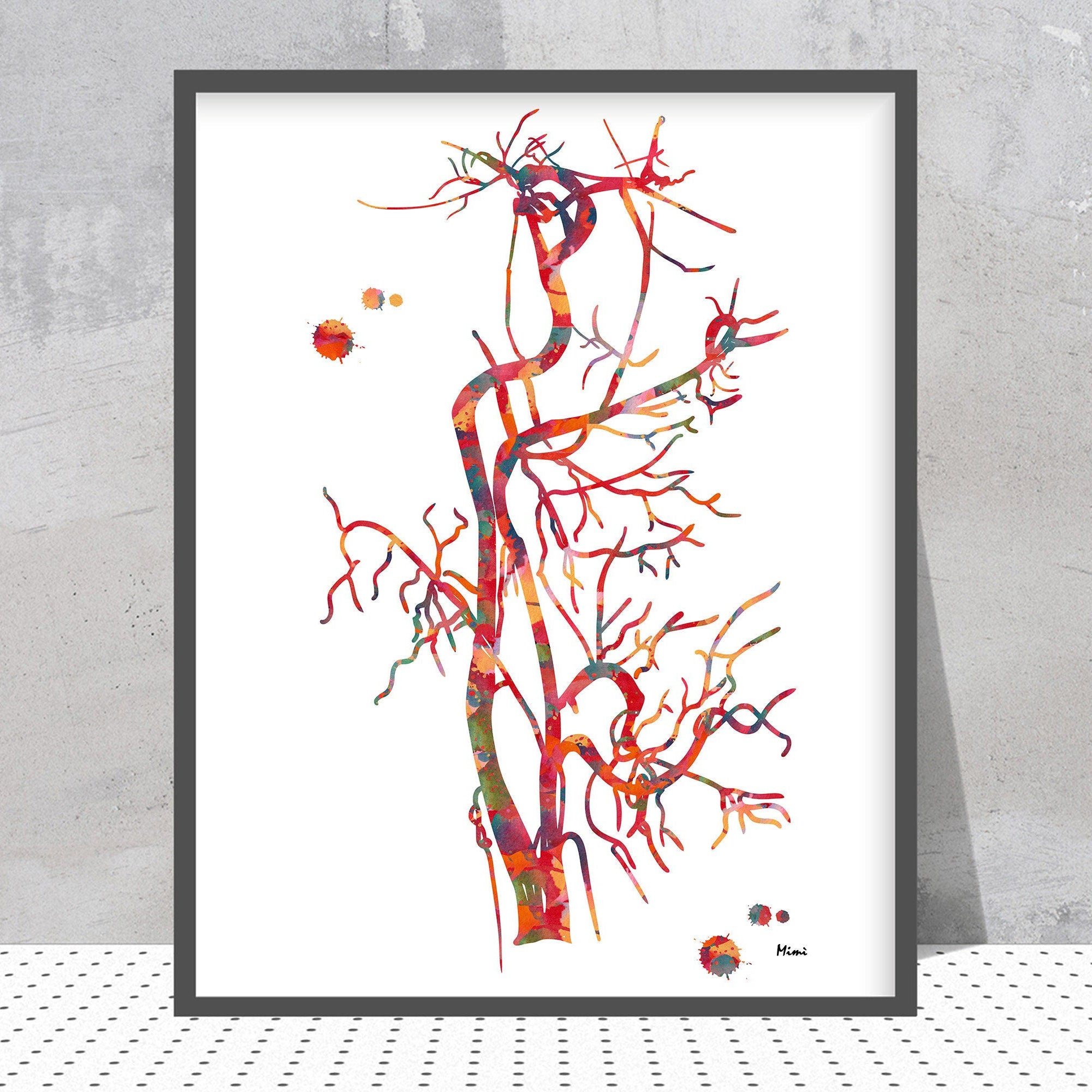 Carotid Artery Angiogram Watercolor Print Image 2