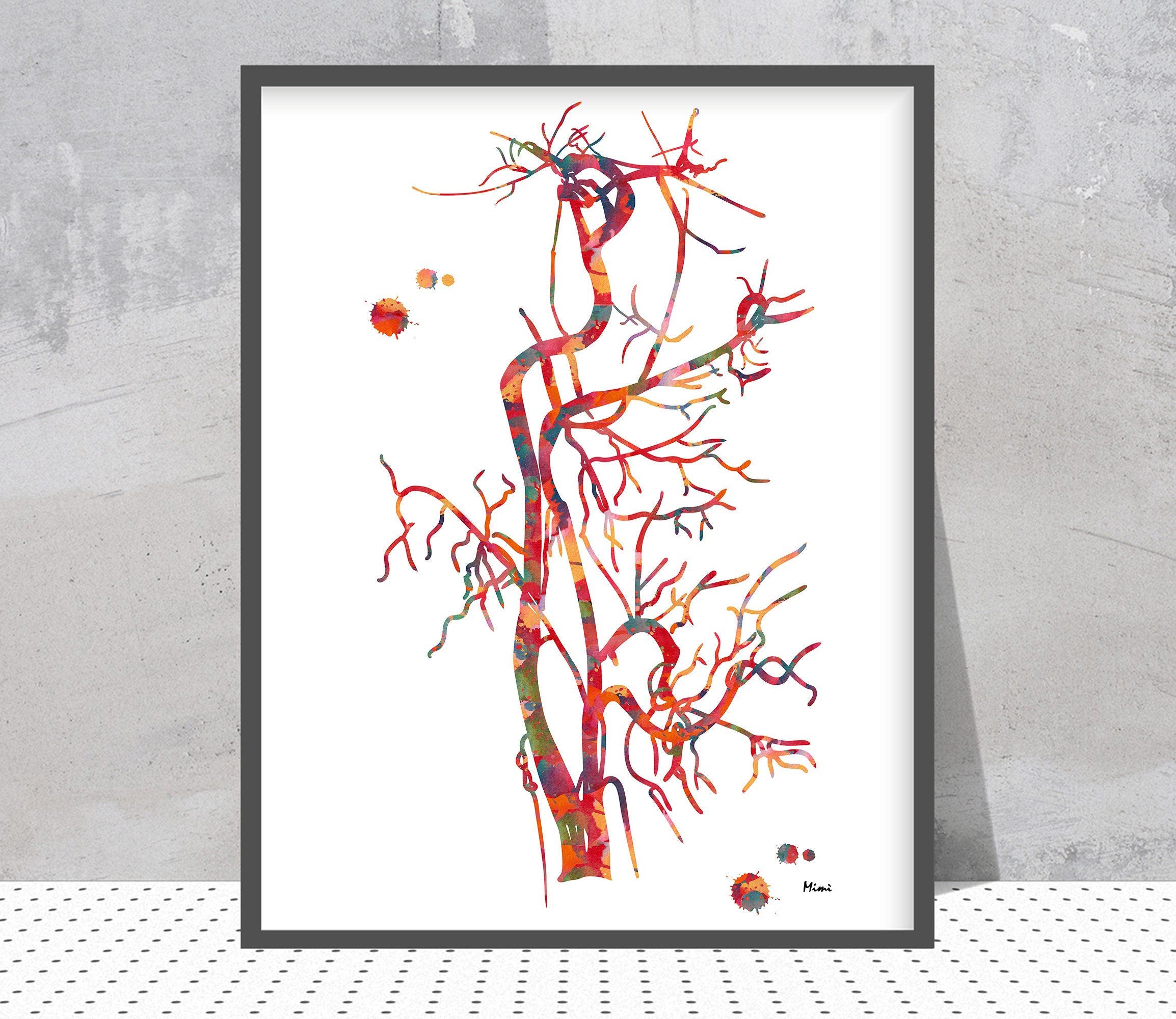 Carotid Artery Angiogram Watercolor Print Image 2