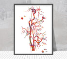 Carotid Artery Angiogram Watercolor Print Image 2