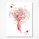 Cerebral Angiography Anatomy Print Brain Vascularization