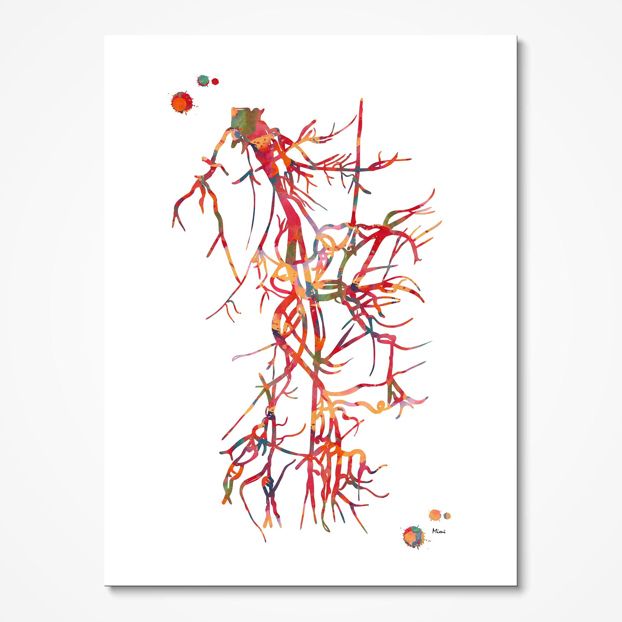 Iliac Femoral Artery Watercolor Angiorgram