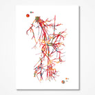Iliac Femoral Artery Watercolor Angiorgram