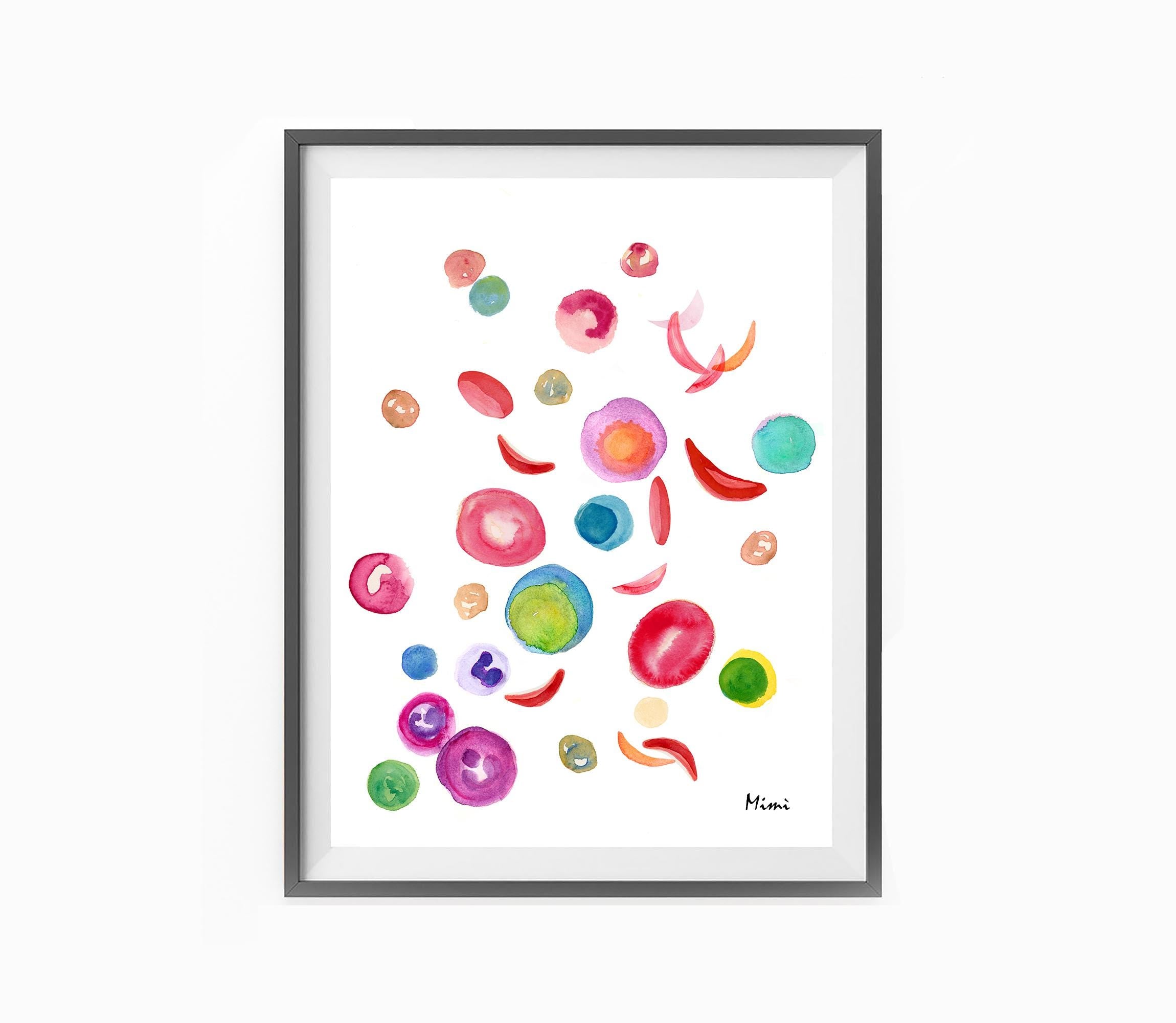 Framed artwork with MimiPrints' Sickle Cell Anemia Watercolor Print on a white background