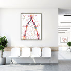 Framed abdominal aorta and pelvic arteries angiogram watercolor print in a clinic waiting room