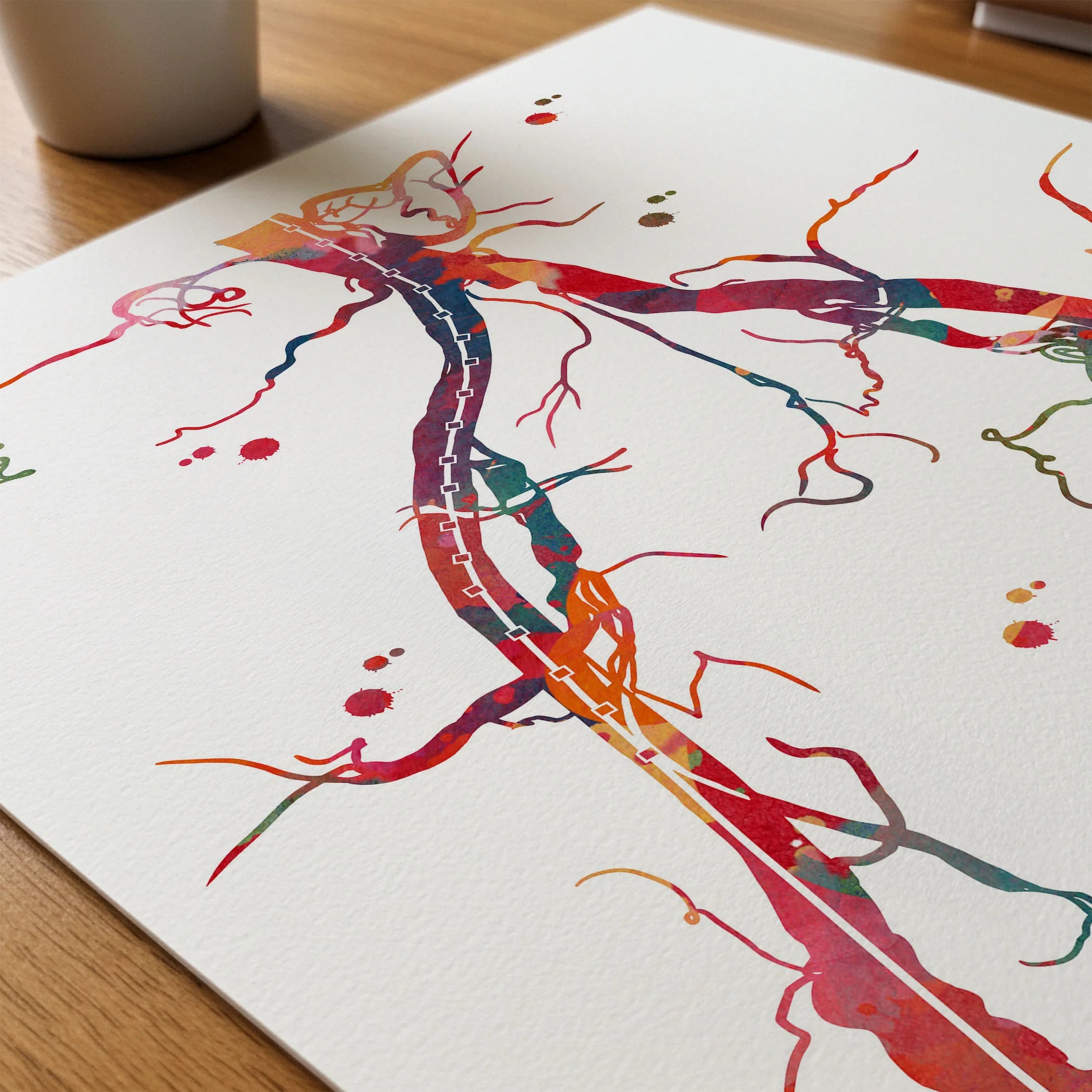 Close-up of abdominal aorta and pelvic arteries angiogram watercolor print showing paper texture and grain