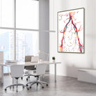 Framed abdominal aorta and pelvic arteries angiogram watercolor print in a vascular clinic