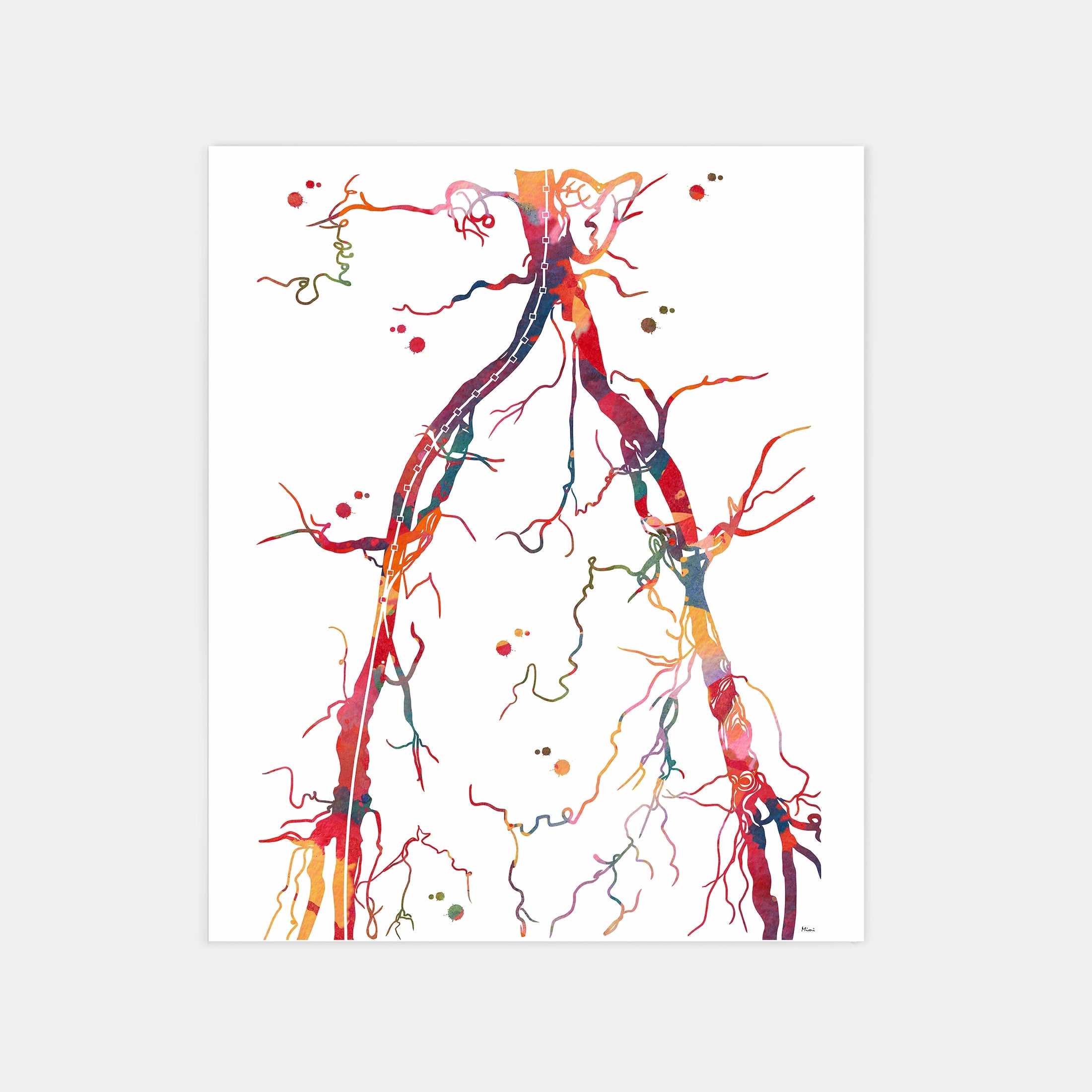 Abdominal aorta and pelvic arteries angiogram watercolor art print for vascular clinic wall decor