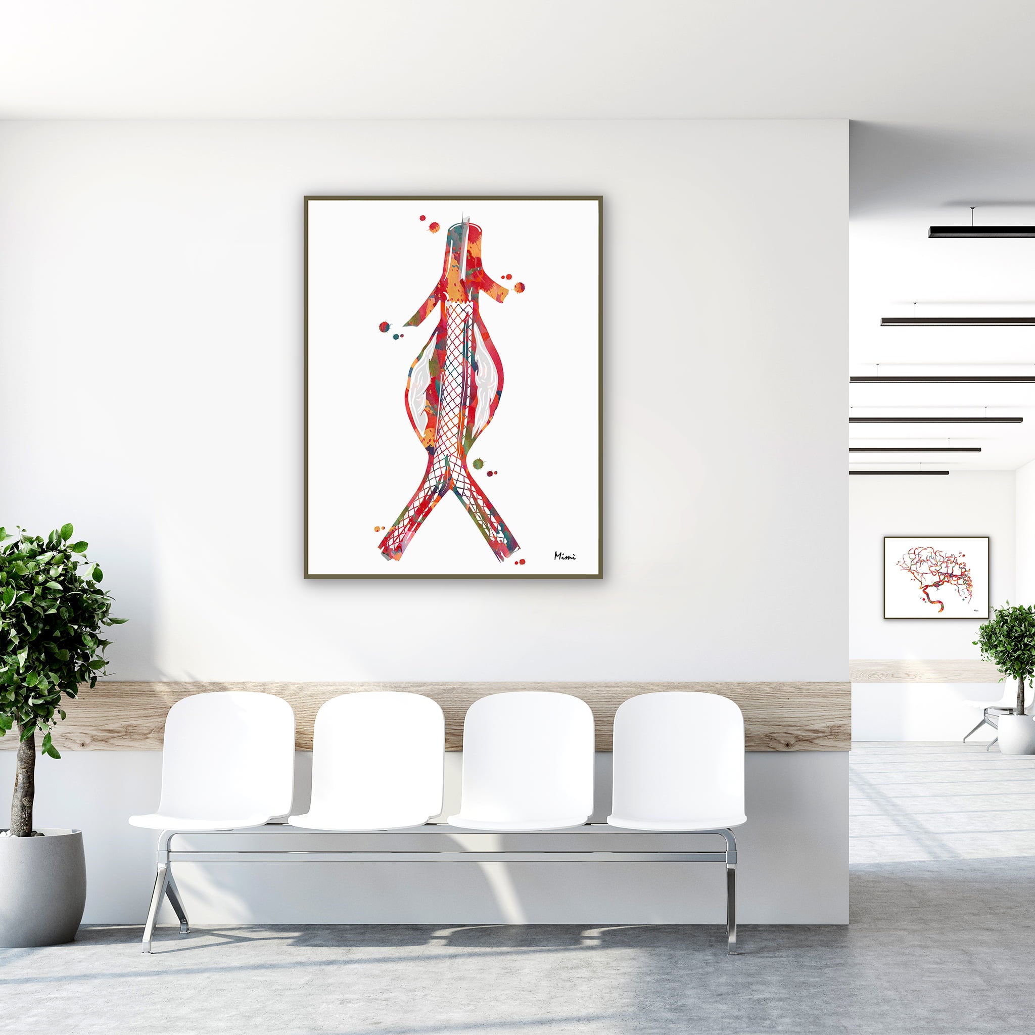 Framed abdominal aortic stent watercolor print in a clinic waiting room