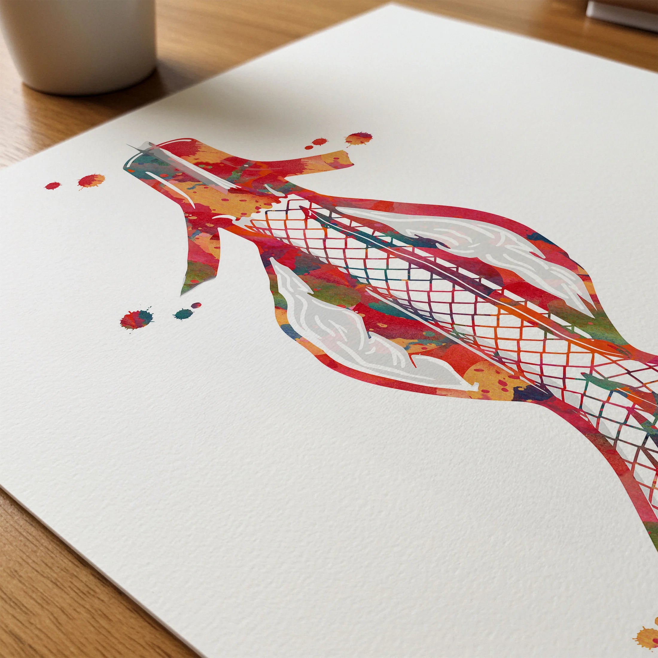 Close-up of abdominal aortic stent watercolor print showing paper texture and grain