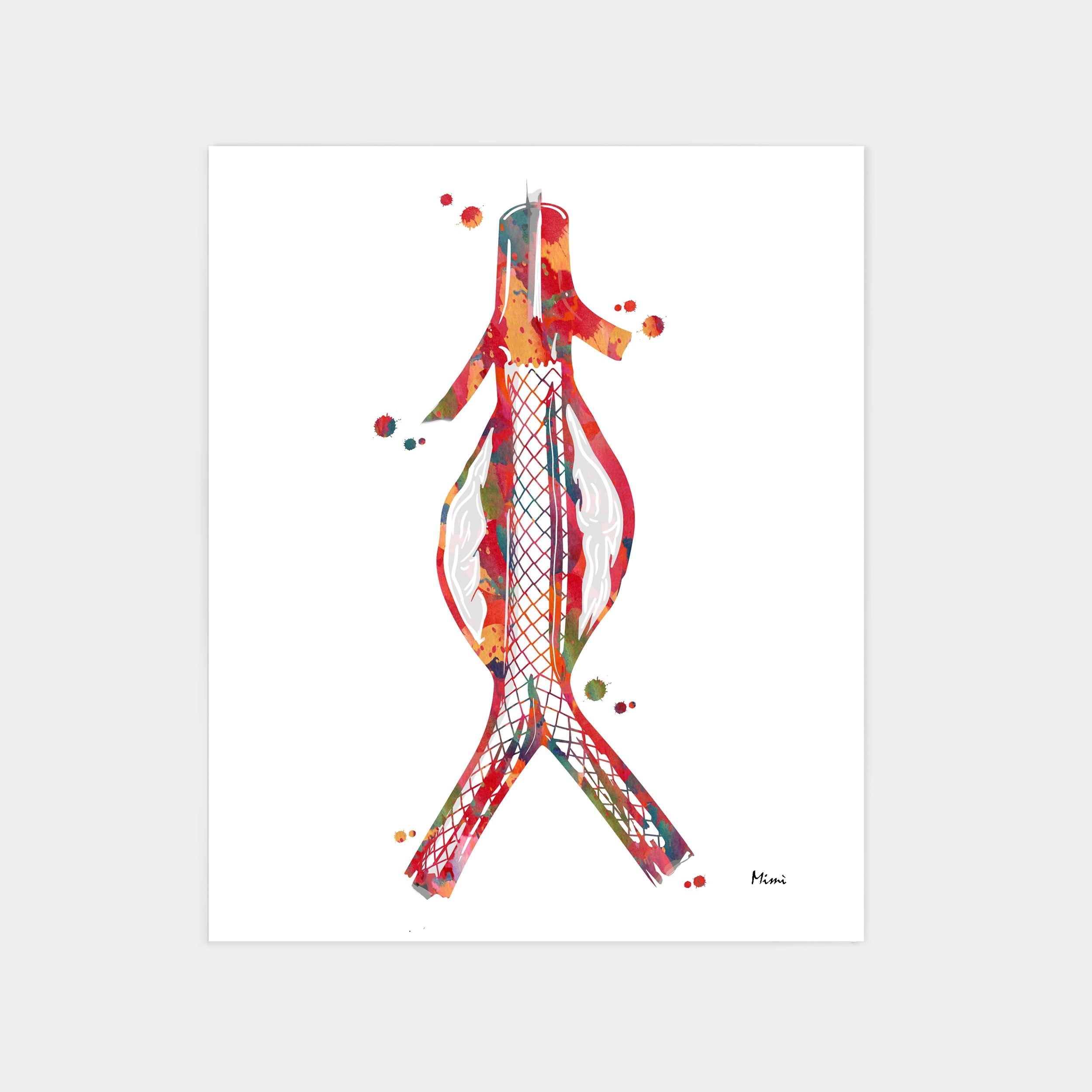 Abdominal aortic stent watercolor art print for vascular clinic wall decor