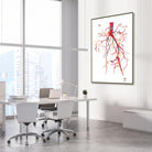 Framed aorta angiogram watercolor print in a vascular clinic