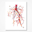 Aorta angiogram watercolor art print for angiology clinic wall decor