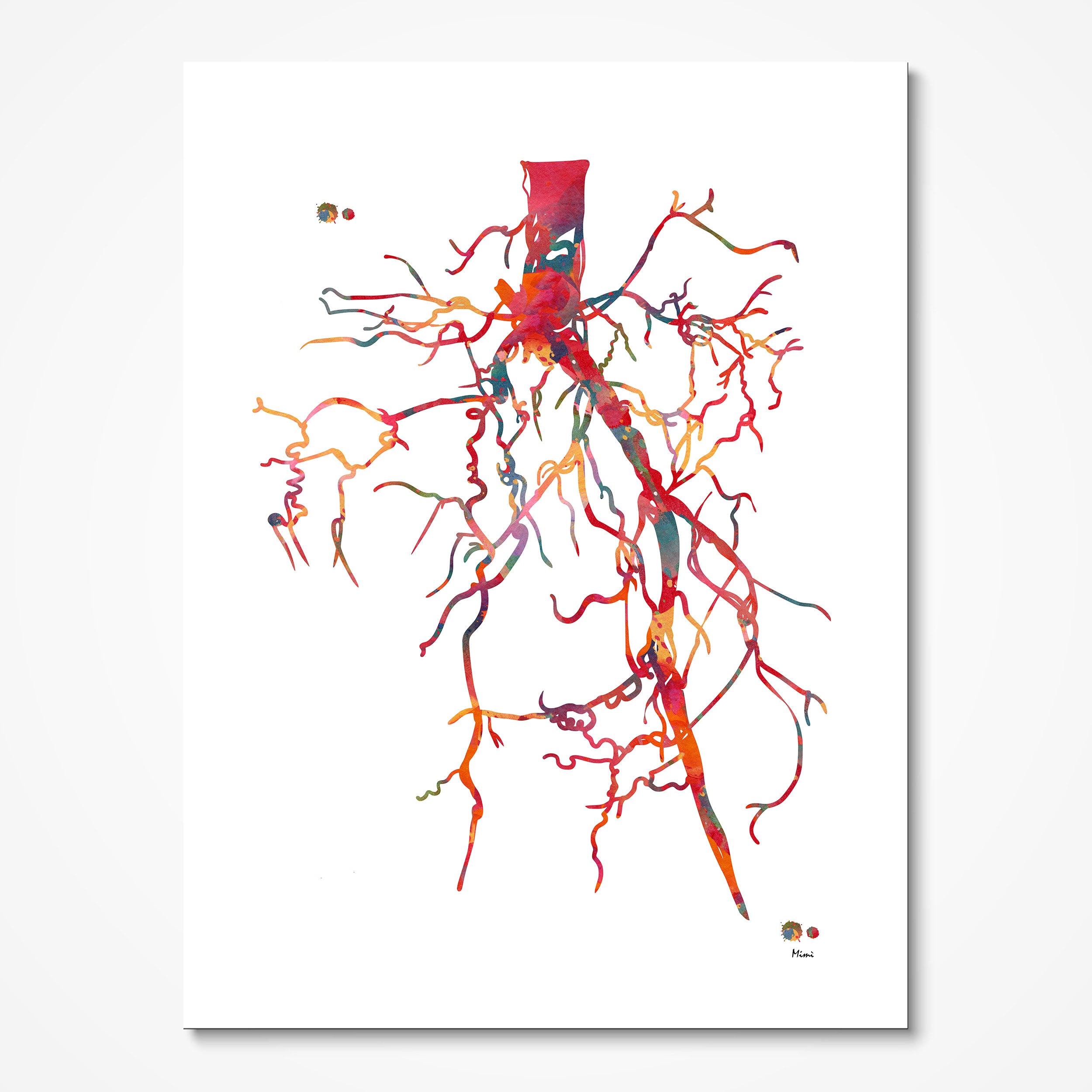 Aorta angiogram watercolor art print for angiology clinic wall decor