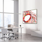 Framed aorta cross-section histology watercolor print in a vascular clinic