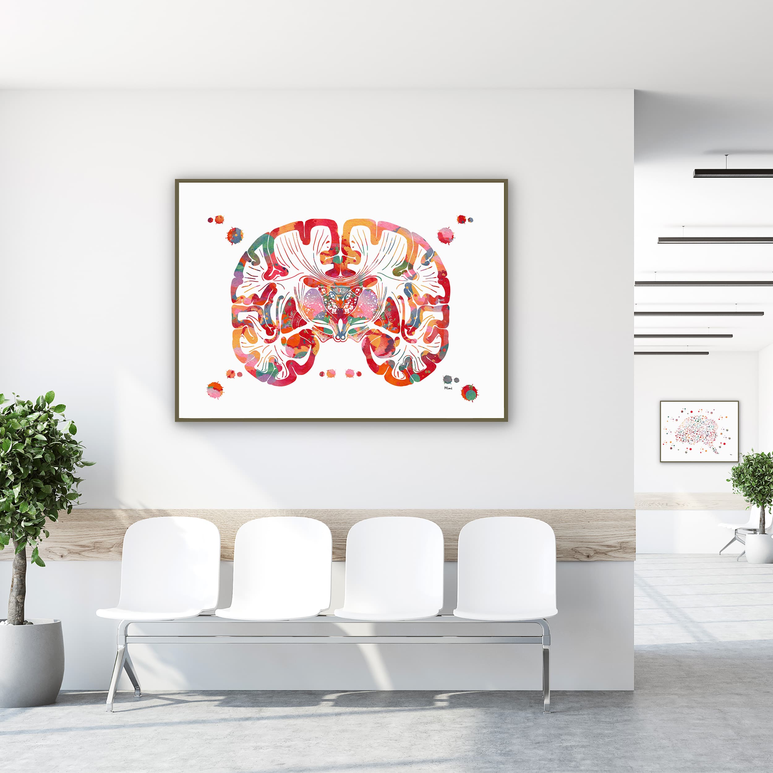 Framed brain coronal section anatomy watercolor print in a clinic waiting room