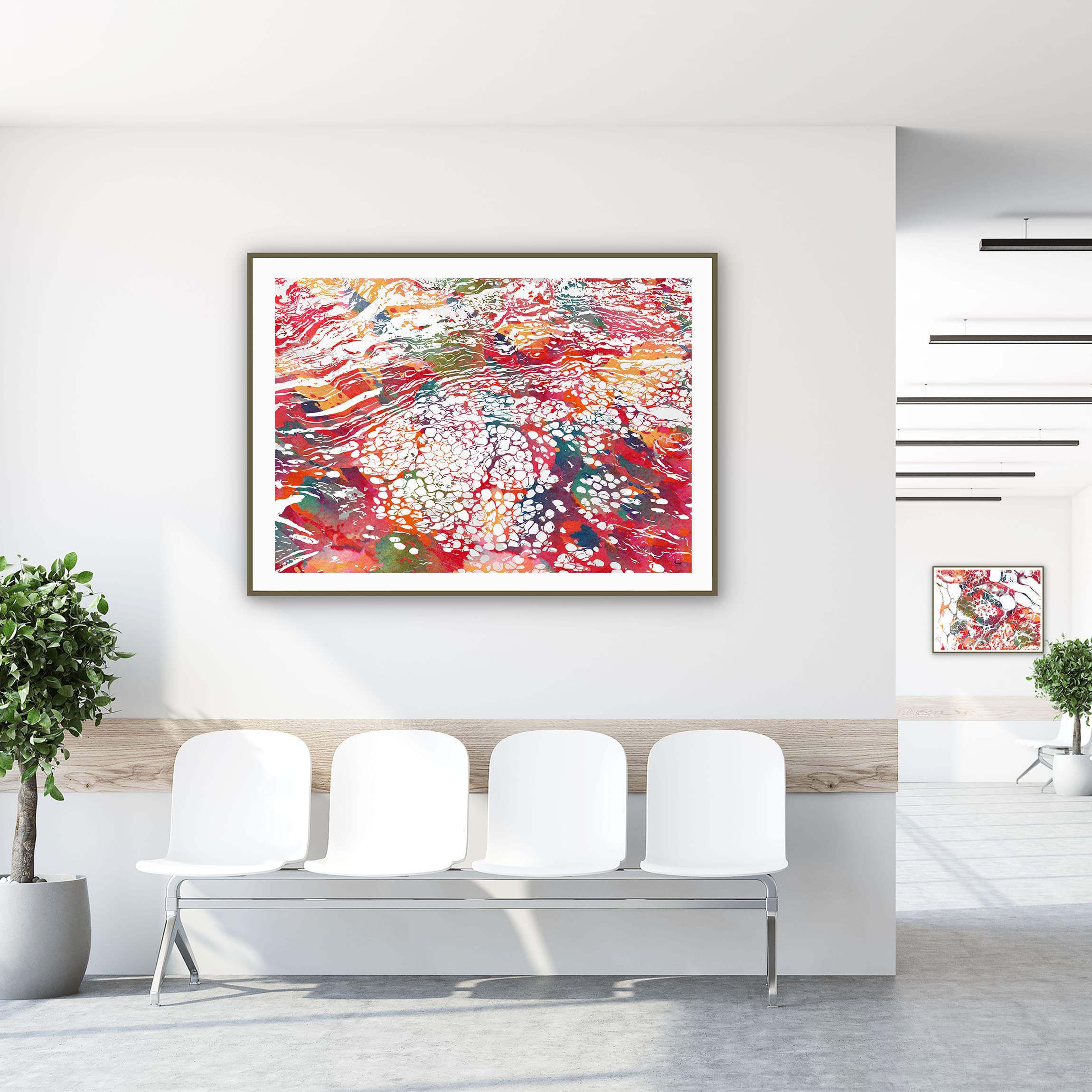 Framed breast tissue histology watercolor print in a clinic waiting room
