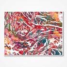 Breast Cancer Histology Watercolor Print Listing Image 1