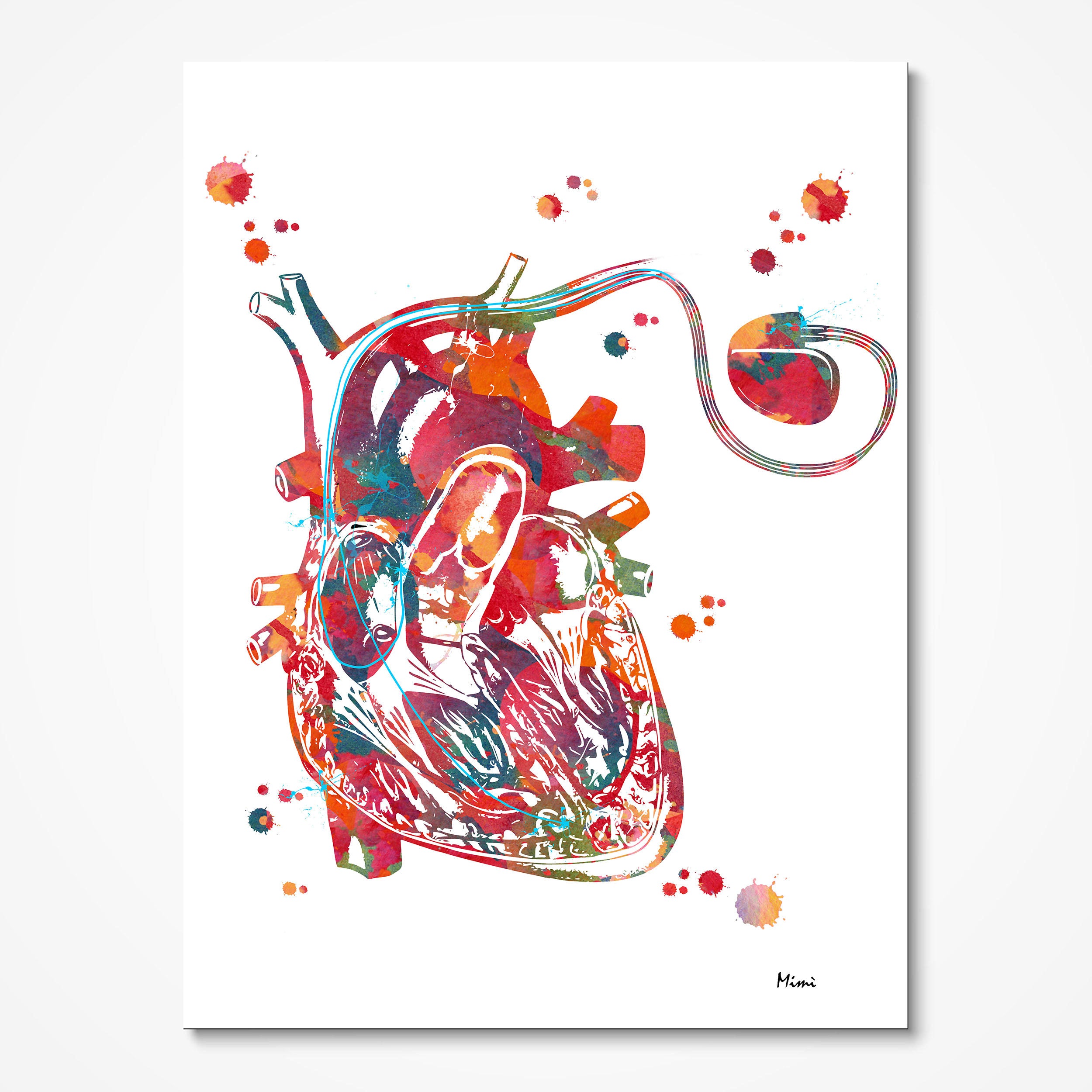Cardiac pacemaker watercolor art print for cardiology clinic wall decor
