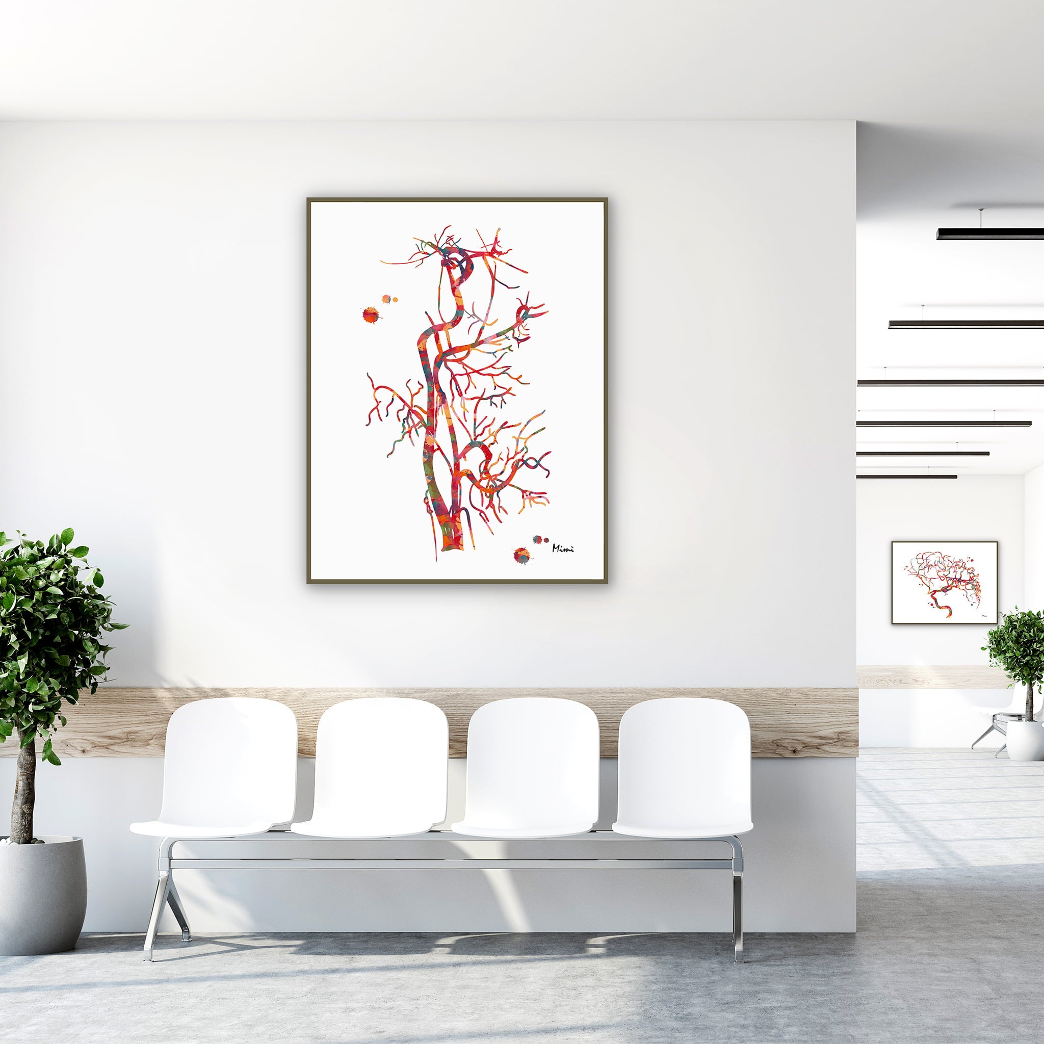 Framed carotid artery angiogram watercolor print in a clinic waiting room