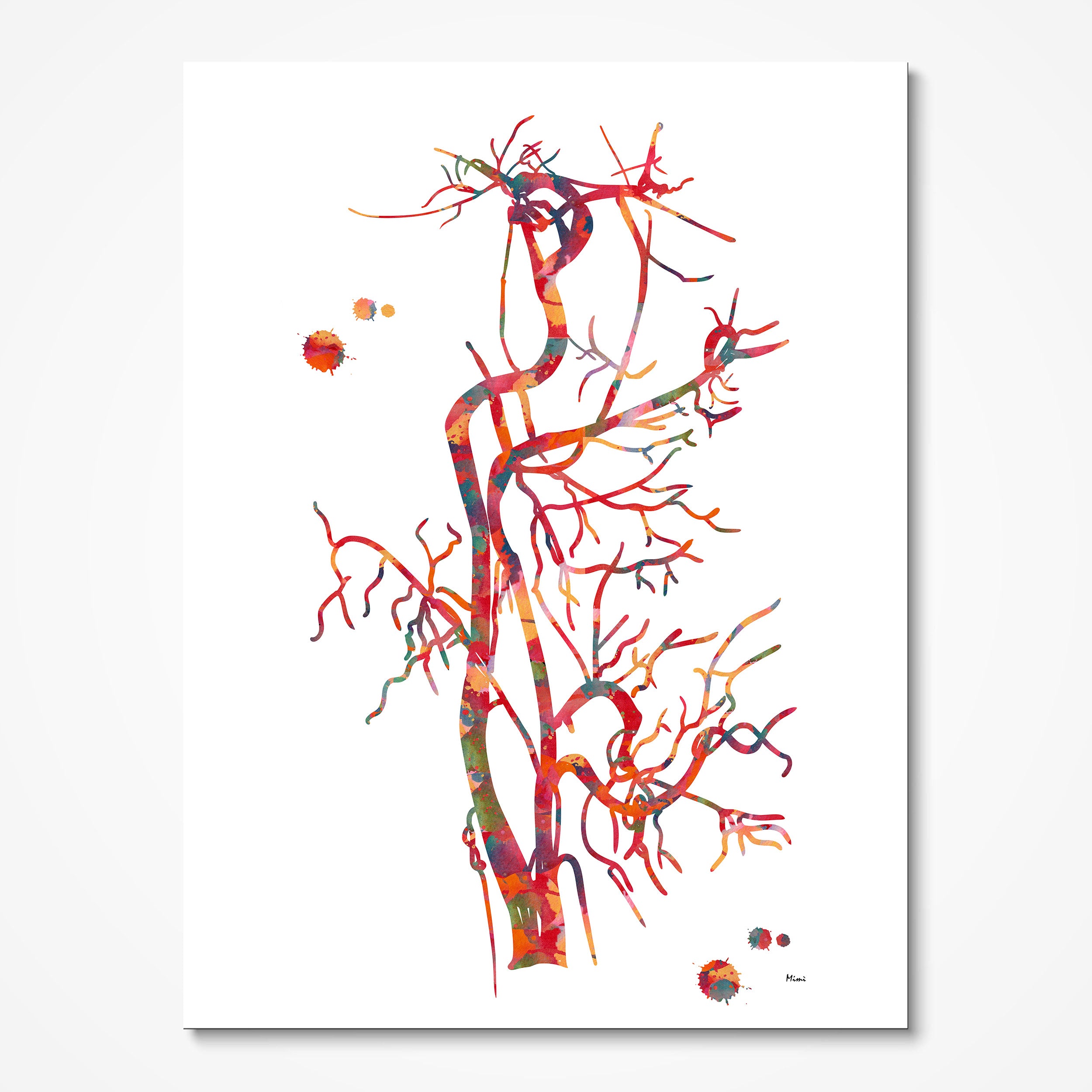 Carotid artery angiogram watercolor art print for vascular clinic wall decor