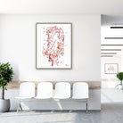 Framed cerebral aneurysm brain angiogram watercolor print in a clinic waiting room