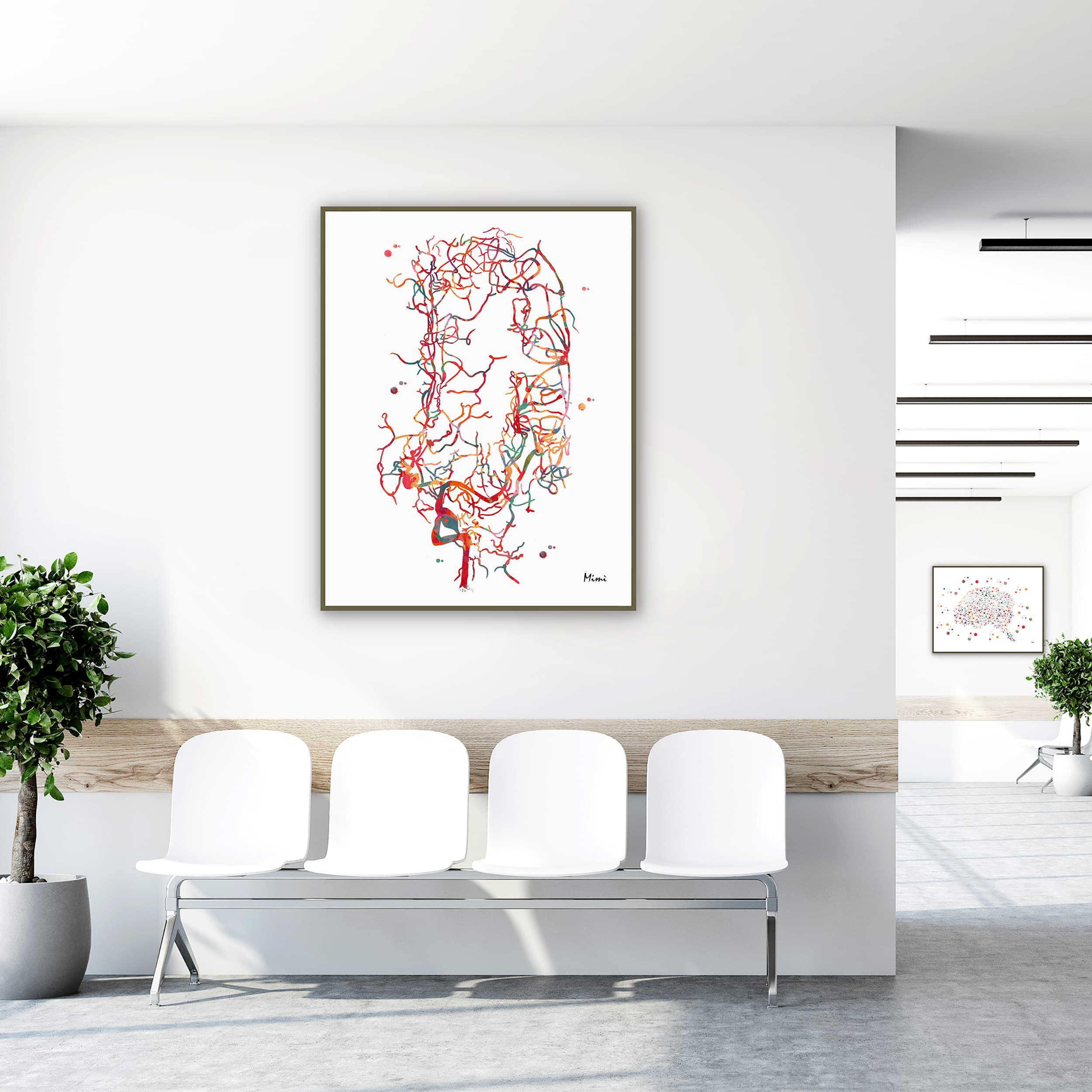 Framed cerebral aneurysm brain angiogram watercolor print in a clinic waiting room