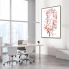 Framed cerebral aneurysm brain angiogram watercolor print in a neurology clinic