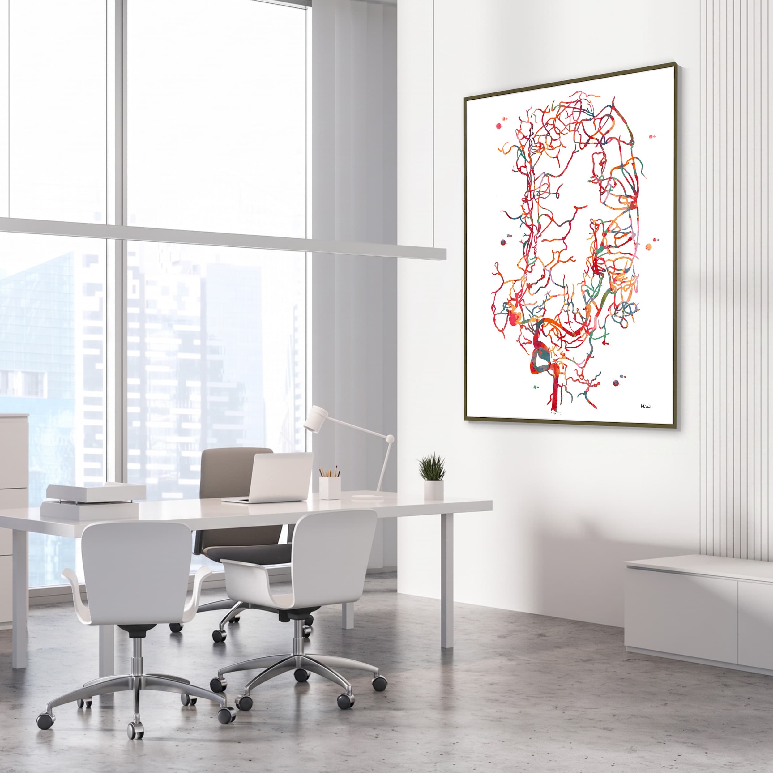 Framed cerebral aneurysm brain angiogram watercolor print in a neurology clinic