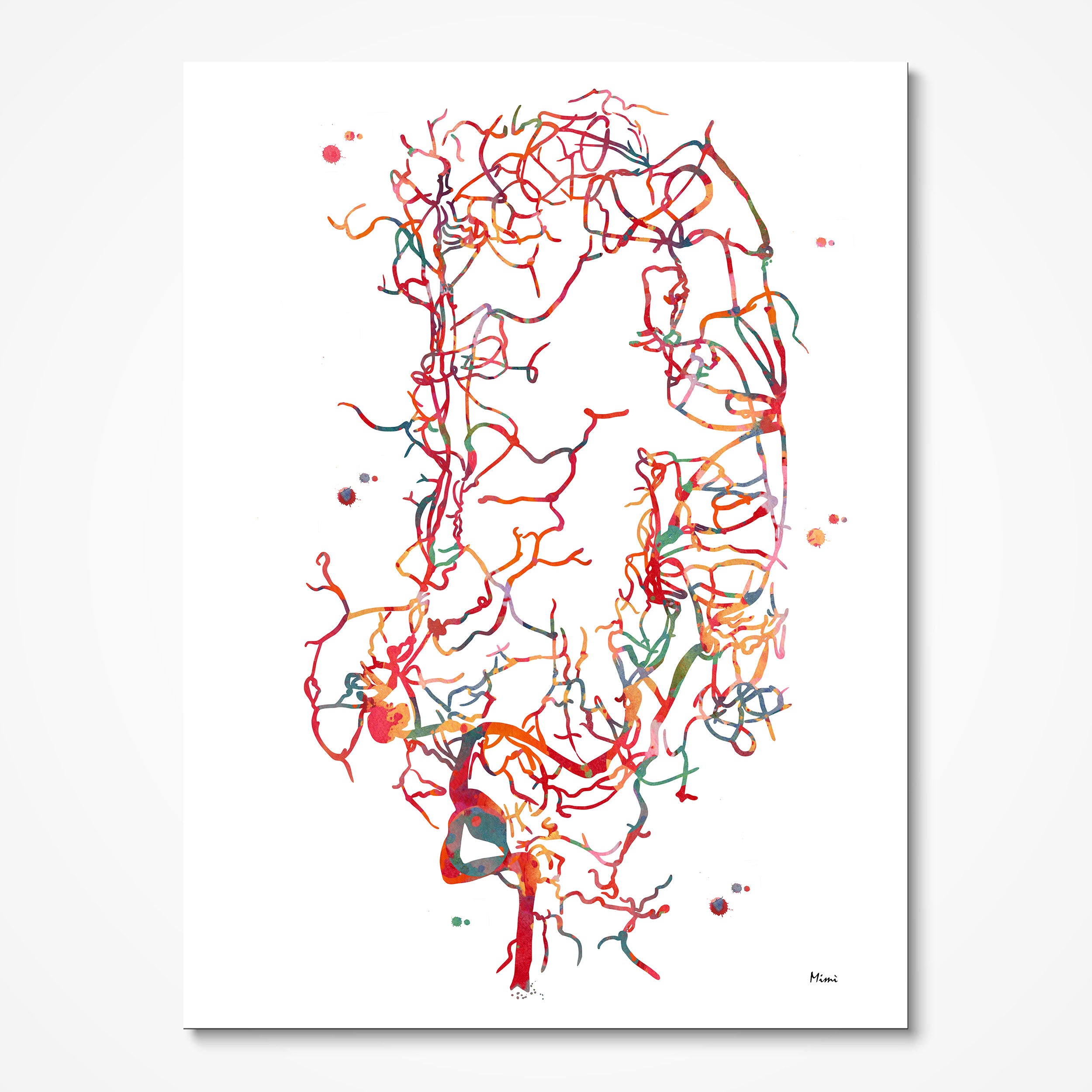 Cerebral Aneurysm Brain Angiogram watercolor art print for neurosurgery wall decor