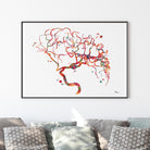 cerebral aneurysm watercolor print hanging in a warm living room