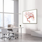 cerebral aneurysm watercolor print hanging in a neurology clinic