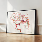 Framed Cerebral Aneurysm watercolor art print for Neurovascular Clinic wall decor