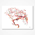 Cerebral Aneurysm watercolor art print for Neurovascular Clinic wall decor