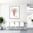 Framed cerebral angiography brain vascularization watercolor print in a clinic waiting room