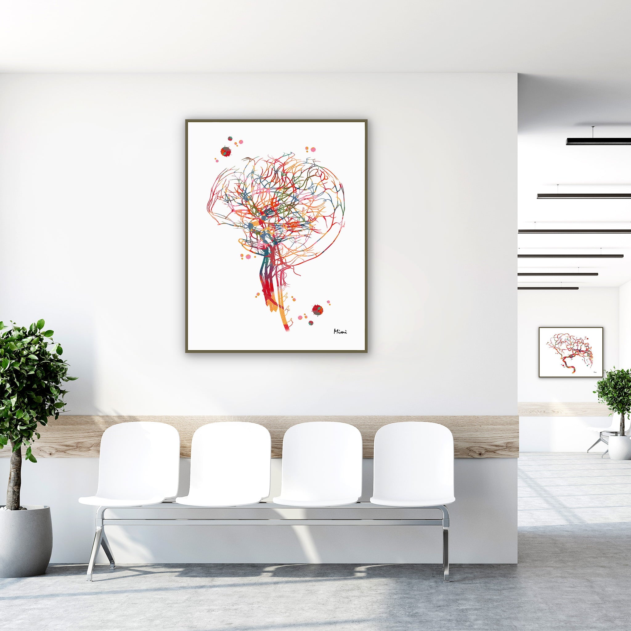Framed cerebral angiography brain vascularization watercolor print in a clinic waiting room