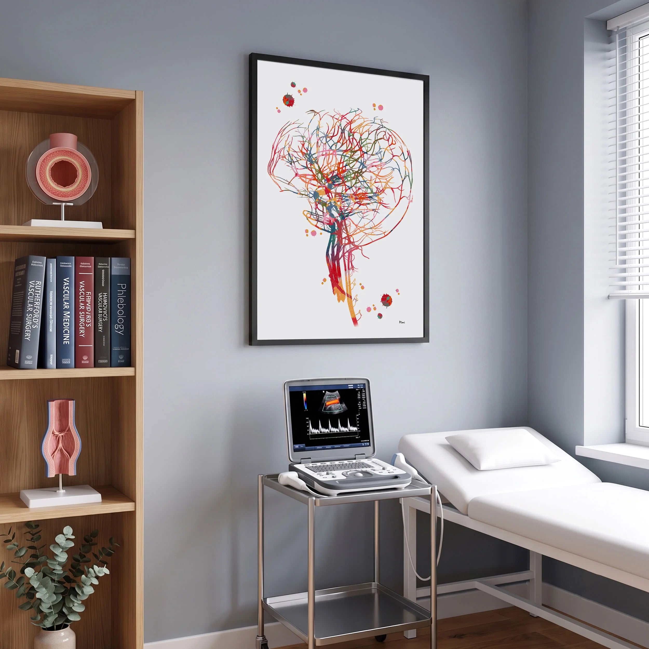 Framed cerebral angiography brain vascularization watercolor print in a vascular clinic