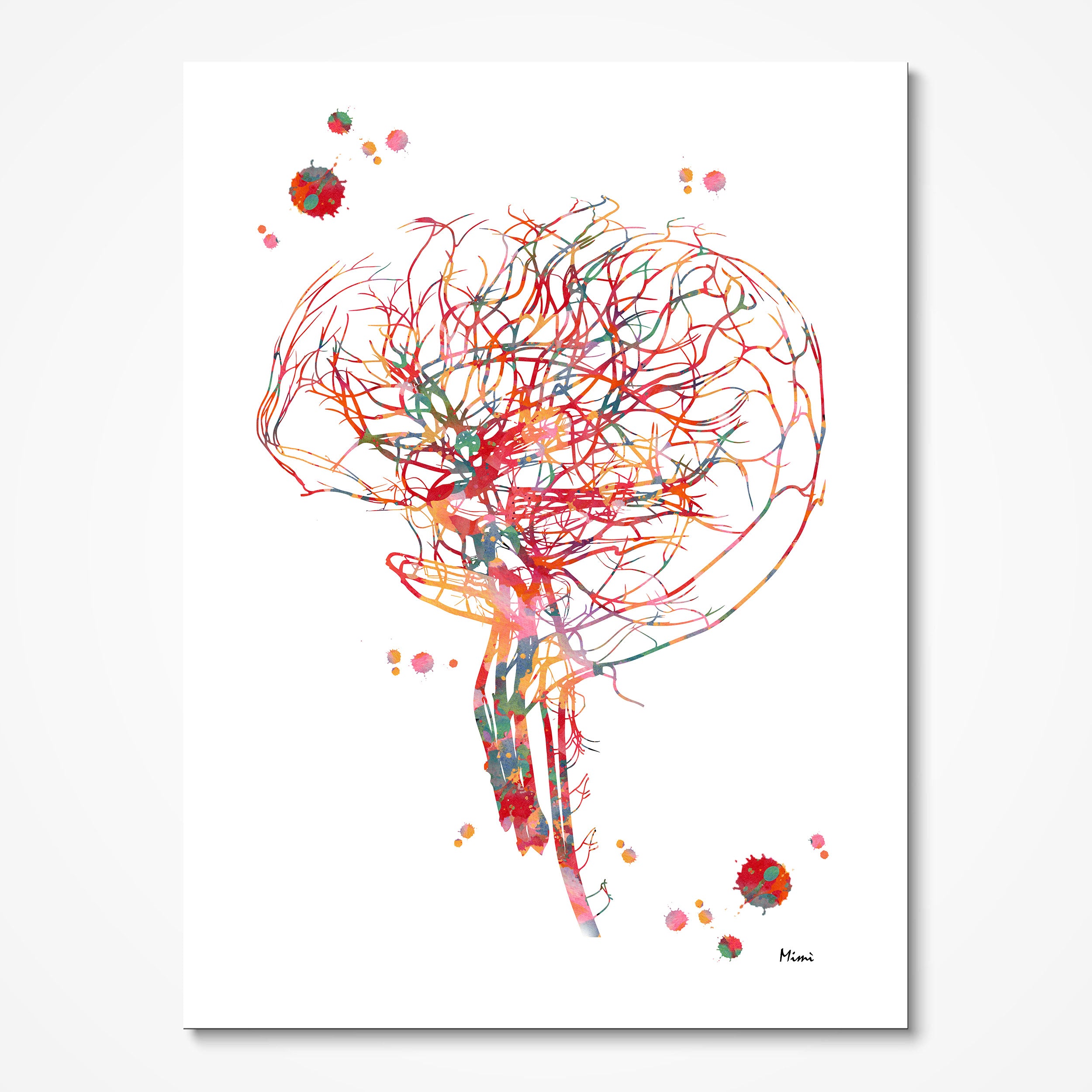 Cerebral angiography brain vascularization watercolor art print for vascular clinic wall decor
