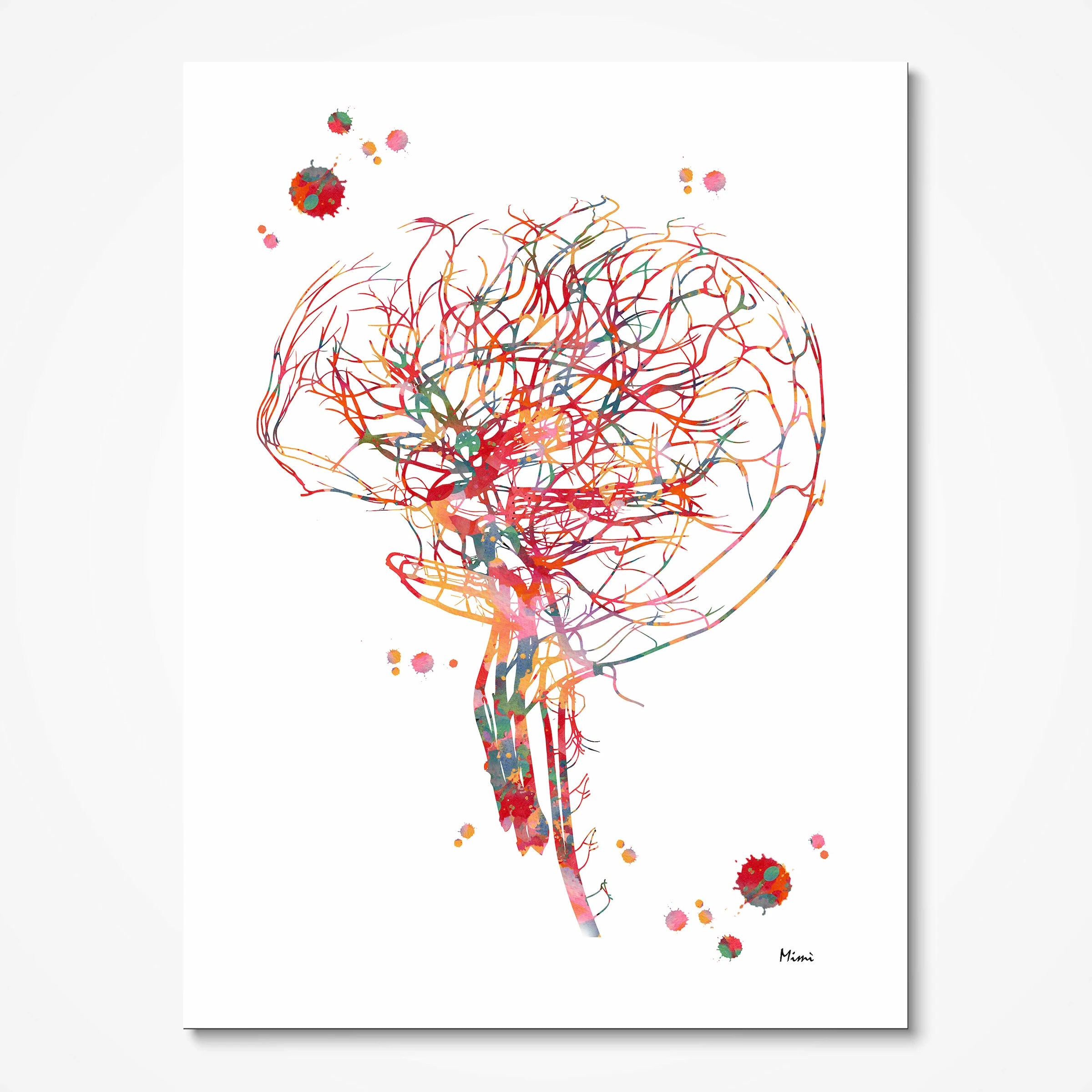 Cerebral angiography brain vascularization watercolor art print for vascular clinic wall decor